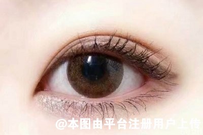 做双眼皮该不该提肌 提肌与不提肌的区别看这里
