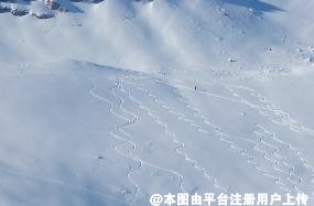 医美小白适合做哪些项目呢