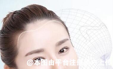 生活压力极大下种植头发还会脱落吗