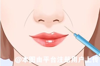 玻尿酸吸收时间长短与哪些因素有关