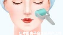想改善肌肤问题 可以试试黄金微针-35248