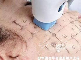 做完热玛吉脸塌了 需要考虑这两个因素
