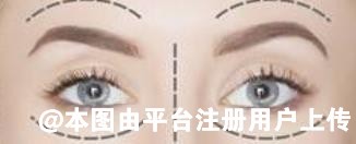 眼距宽想开眼角 但没有内眦赘皮能开眼角吗