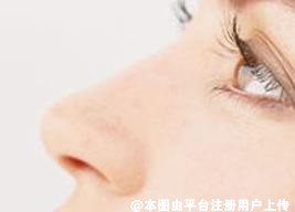 鼻尖做的太高了怎么办 如何补救-36140