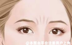 看起来总是愁眉不展的 这是因为眉间的川字纹
