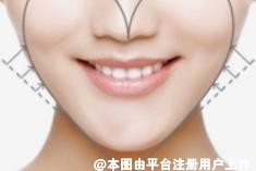 在自体脂肪填充的路上 你需要避开这几个误区