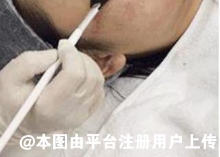 过年有哪些医美项目值得推荐的 看过来