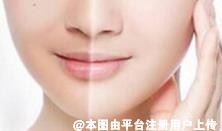 拒绝无效美白 靠谱的美白方法都在这