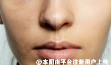 为什么年纪越大皮肤越容易显黄 暗黄是皮肤初老的表现吗