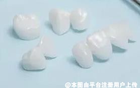 想要牙齿洁白美观 可以试试全瓷牙-37575