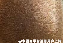清凉一夏 这个夏天你脱毛了吗