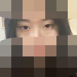 做完双眼皮 眼睛亮了好多-37953