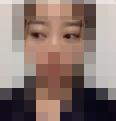 双眼皮修复好了 我悬着的心终于可以放下了-38038