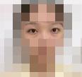 我真的受够了这显老的眼袋 花钱去掉啦