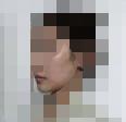 做了颧骨整形真的太值得啦 自拍发朋友圈点赞都变多了呢-38123