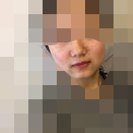 感觉这次隆鼻很值 效果真好