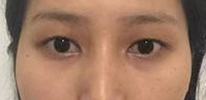 整体改变还是挺大的 眼睛变得更大更有神了-38130