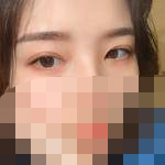 双眼皮术后很自然 一般人看不出来-38203