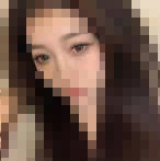 现在闭眼已经看不太清楚疤痕了-38320