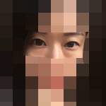 祛完眼袋 整个人精神焕发