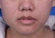 做了鼻子以后整个人都变得有气质多了-38446