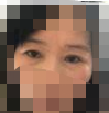 对比提眉术前的我真的年轻自信了很多-38721
