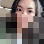 双眼皮的宽度没有之前那么宽了 现在更自然了
