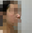 和我的好姐妹一起做的鼻子 她美我也美-38764
