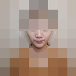 做完隆鼻后 自信心也起来了
