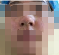 做了鼻子之后衬得我整个脸都变的精致立体了呢-38876