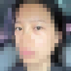 现在双眼皮已经自然太多了-39041