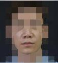 男孩子也可以做医美-39093