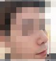 男孩子也可以做医美-39092