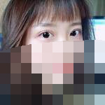 双眼皮提升颜值显而易见-39226