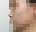朋友都说我做这个鼻子赚到了呢