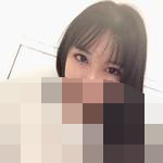 做完双眼皮 眼睛变得很好看很温柔-39398
