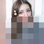 双眼皮消肿出乎意料的快-39493