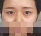感谢自己勇敢去做双眼皮