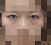 没有了眼袋 眼睛变得好好看