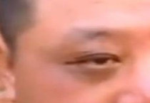 给大家聊聊“熊猫眼”的那些事情，我们应该这样去对付它