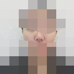 隆完鼻发现 变美真的很快