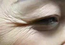 给大家说说如何祛除眼部皱纹