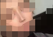 现在鼻子非常完美 比之前的塌鼻子好看多了-40735