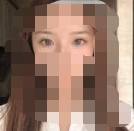 做完眼综合眼睛真的大了很多 也更加有神了