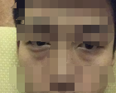谁说男生不能做医美的 看我现在多帅-41095