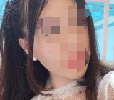 脂肪在脸上存活得很好 正如我所希望的那样-41281
