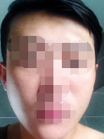 谁说男人不能做美容的 我做了水光后变的更帅了