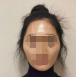 为了变美 忍着这点痛苦还是划算的-41508