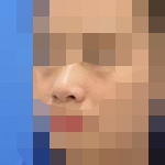 鼻子变挺了很多 人也漂亮了许多-41546