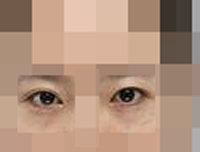 眼睛恢复是很好的还是挺自然的感觉挺满意-41637